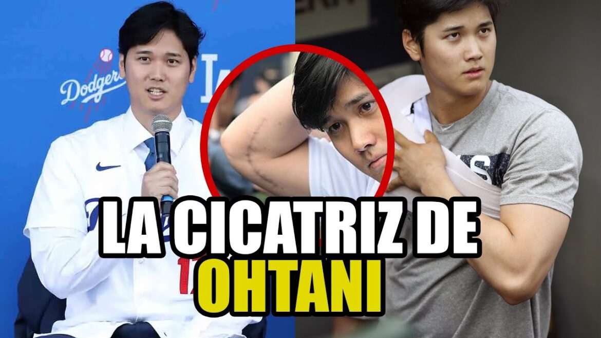LA CICATRICE CHOQUANTE DE SHOHEI OHTANI APRÈS LE TOMMY JOHN