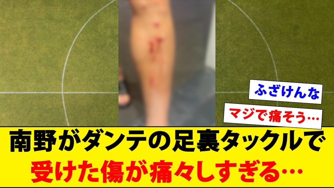 [Avertissement pour un visionnage mineur]La blessure que Takumi Minamino a reçue suite au seul tacle de Dante est trop douloureuse...