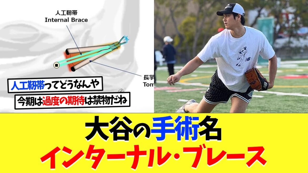 Le chirurgien de Shohei Otani raconte à sa main du coude[réaction à l'étranger][Shohei Otani][Nan J][2CH][baseball professionnel][Koshien][MLB]