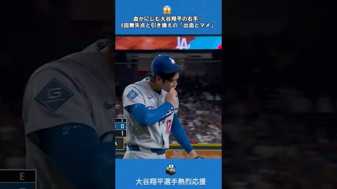 [Effondrement de la glande lacrymale]Main droite ensanglantée... La « dureté de jouer avec deux armes » de Shohei Otani se cache derrière sa 6ème manche sans but