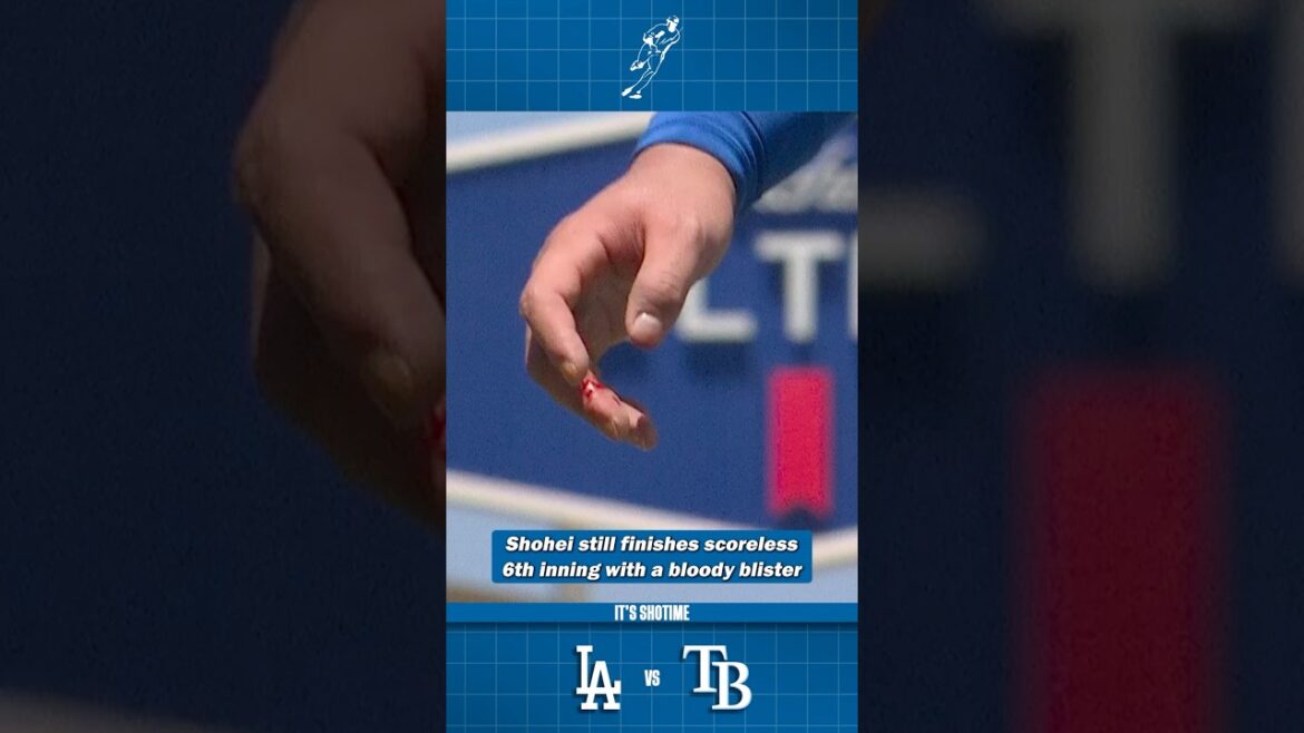 Shohei termine 6e sans but avec une ampoule sanglante
