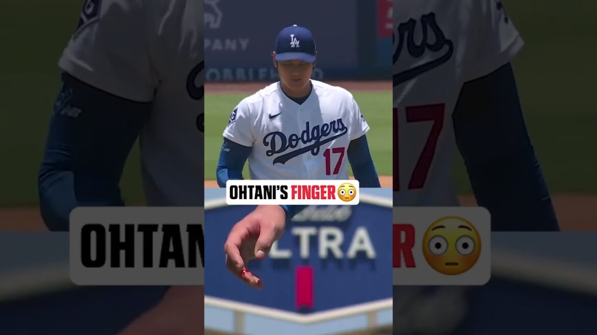 Shohei a quitté le match des Dodgers contre les Rays après avoir accordé 4 ER en 6 IP 😳