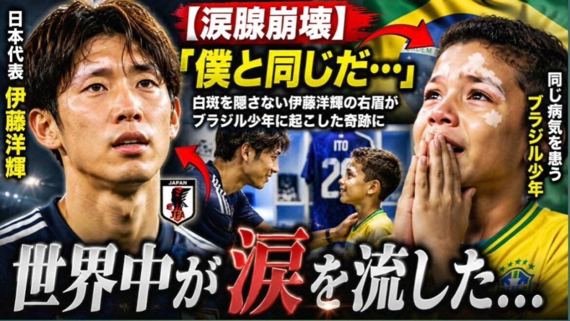 [Effondrement des glandes lacrymales]"C'est comme moi..." Le sourcil droit du représentant japonais Hiroki Ito, qui ne cache pas son vitiligo, verse des larmes dans le monde entier face au miracle qu'il a créé pour un garçon brésilien atteint de la même maladie... #HirokiItō