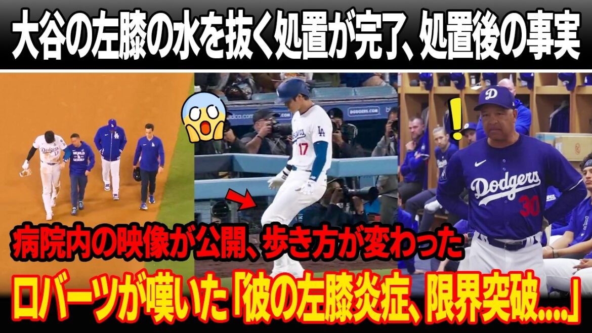 La procédure pour drainer l’eau du genou gauche de Shohei Otani est terminée et les faits révélés après la procédure ! Une vidéo à l’intérieur de l’hôpital a été diffusée et sa façon de marcher a changé… on craint qu’elle ne se propage à Otani ! L’entraîneur Roberts a déploré : « Il a déjà atteint sa limite. » La procédure pour drainer l'eau du genou gauche de Shohei Otani est terminée et les faits révélés après la procédure ! Une vidéo à l'intérieur de l'hôpital a été diffusée et sa façon de marcher a changé... on craint qu'elle ne se propage à Otani ! L'entraîneur Roberts a déploré : "Il a déjà atteint sa limite."